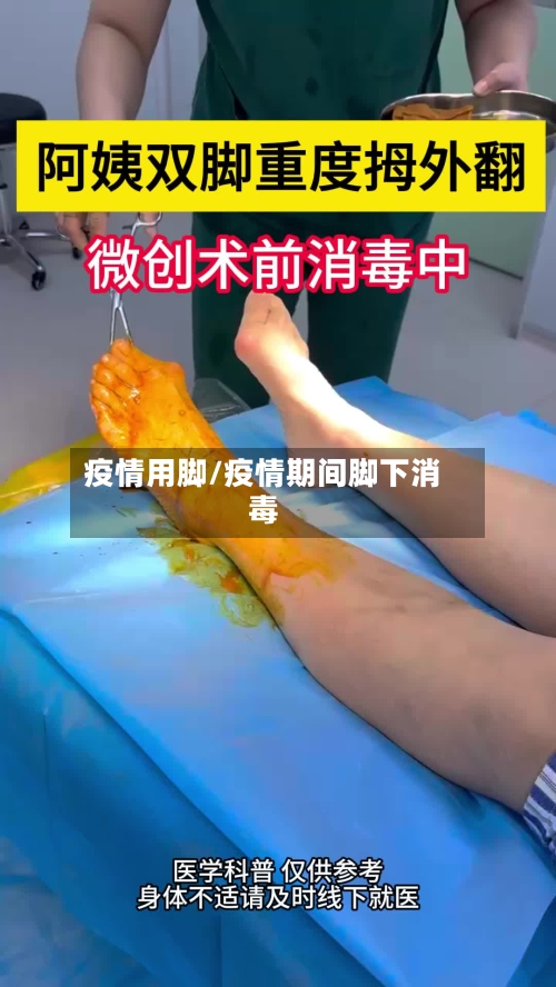 疫情用脚/疫情期间脚下消毒
