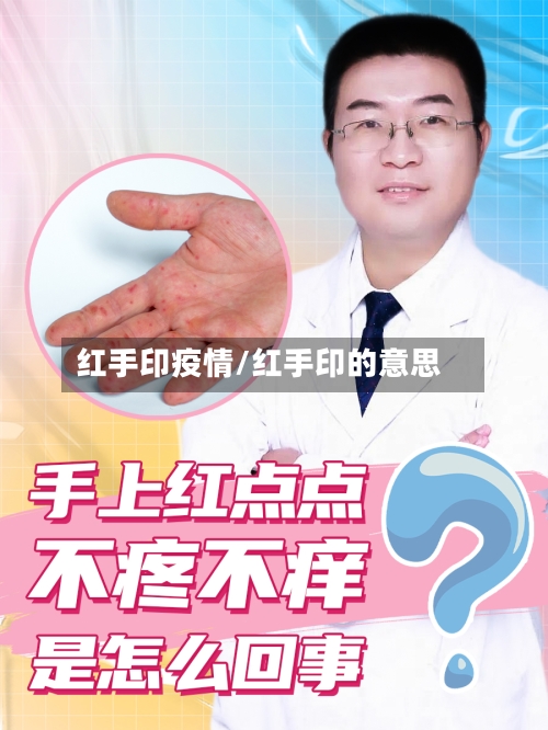 红手印疫情/红手印的意思