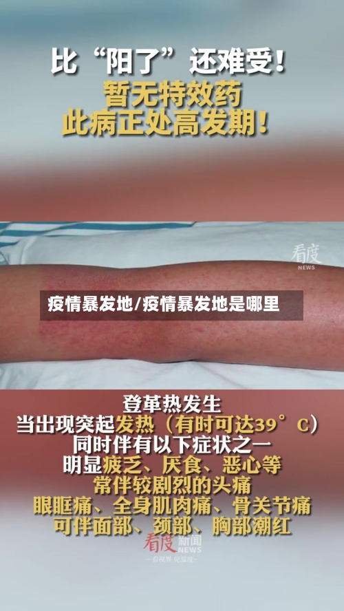 疫情暴发地/疫情暴发地是哪里