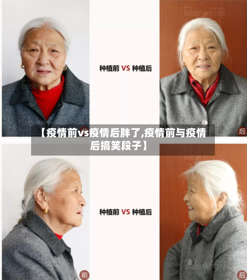 【疫情前vs疫情后胖了,疫情前与疫情后搞笑段子】-第2张图片