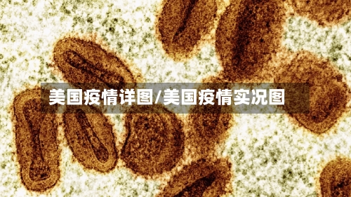 美国疫情详图/美国疫情实况图-第3张图片