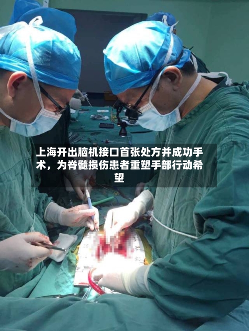 上海开出脑机接口首张处方并成功手术，为脊髓损伤患者重塑手部行动希望-第2张图片